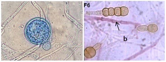 Óosporos de Phytophthora sojae e clamidósporos de Fusarium spp. Ambas as estruturas permanecem viáveis no solo por longos períodos e são microscópicas, ou seja, não são visualizadas a olho nu